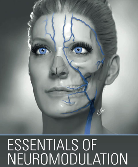 Essentials of Neuromodulation feat
